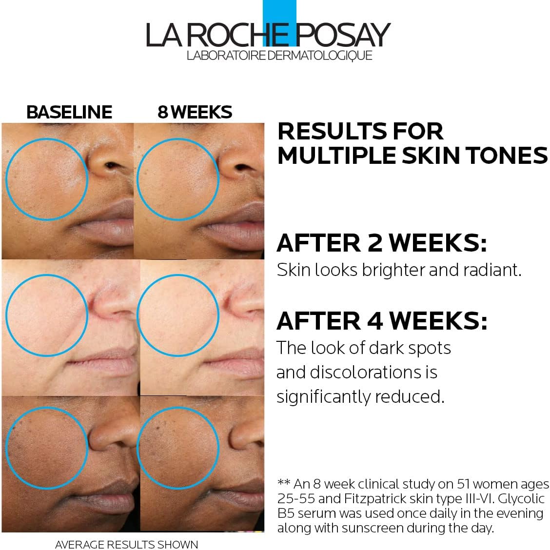 La Roche Posay Mela-D Pigment Control (30ml/1.01oz)