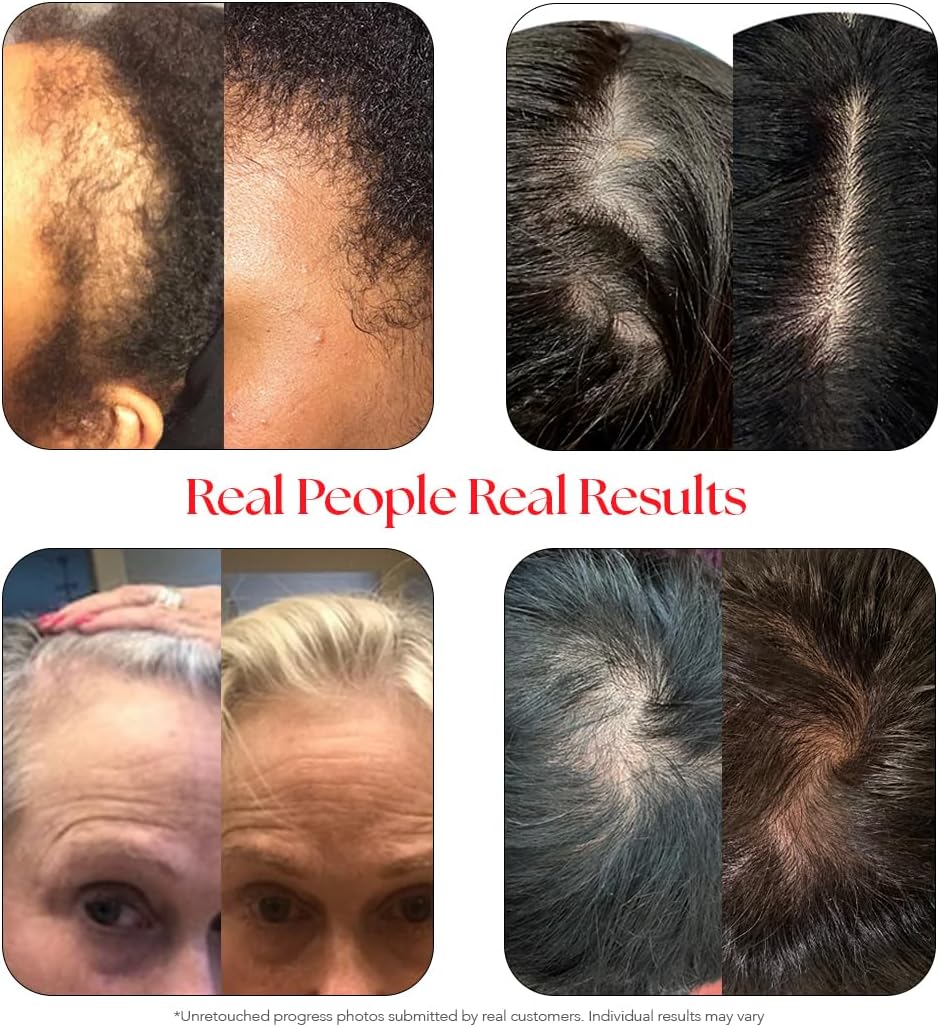 HAIRtamin Scalp Serum Natural Hair Growth Thickening Treatment | Visibly Increases Thicker Looking Hair and Promotes Scalp Health | Nourishes & Hydrates Dry, Itchy Scalp