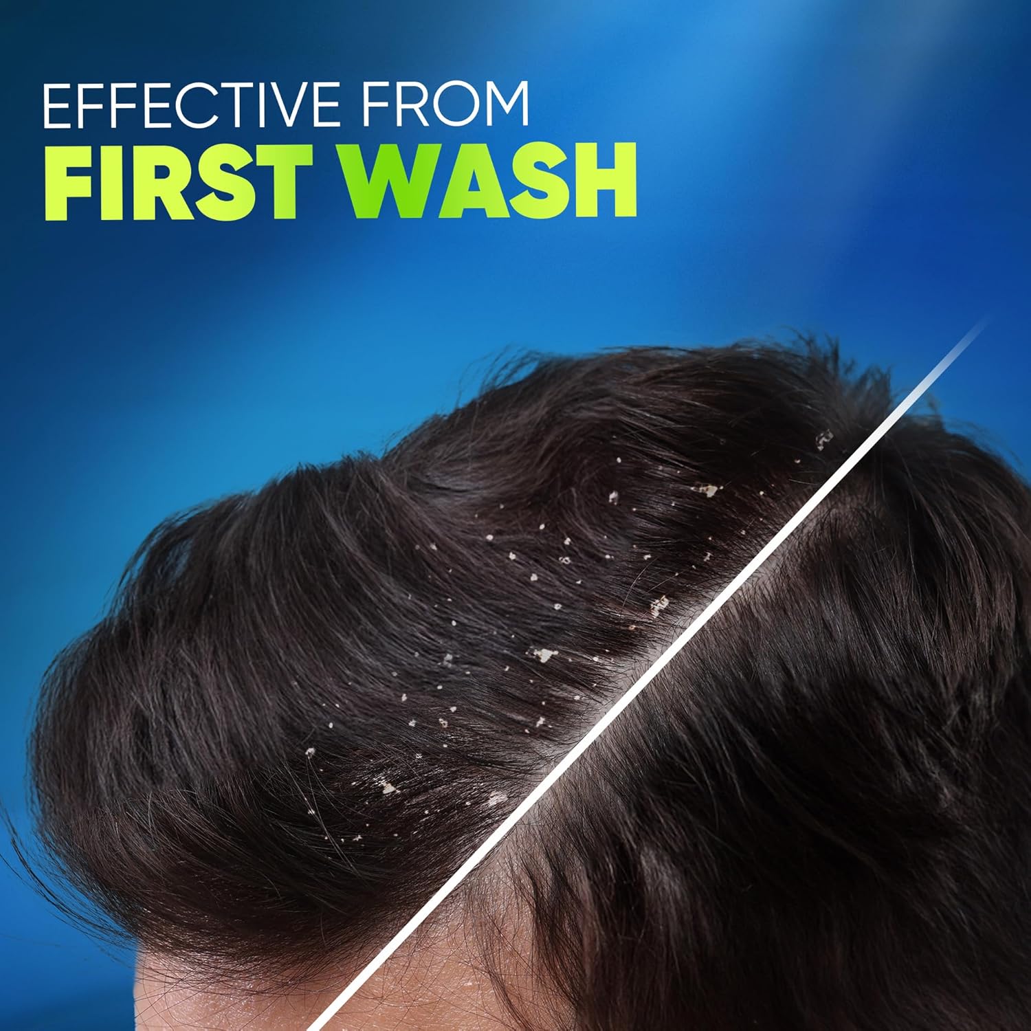 Head & Shoulders Deep Clean For SEVERE Itchy Scalp, Anti-Dandruff Shampoo, Free of Silicones, Parabens and Paraffins, 400 ml